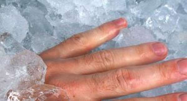 Охлаждение ушибленной ногтевой пластины с помощью льда